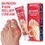 Bunion Pain Relief Cream for Big Toe Bone - ComfyFootgear