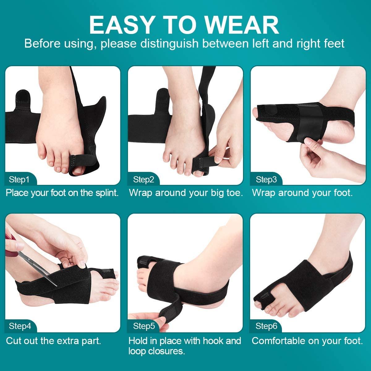 Bunion Splint for Severe Bunion - Bunion Free