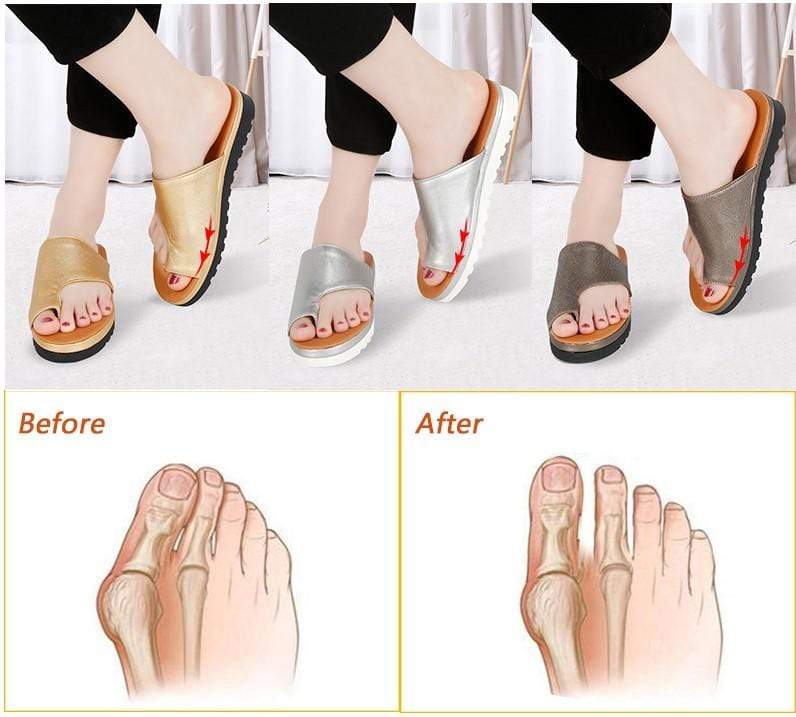 BunionFree™ Bunion Correction Sandals - Bunion Free