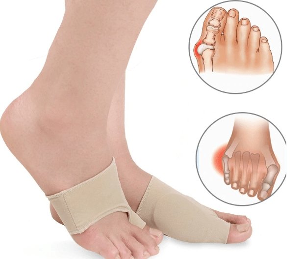 BunionFree™ Gel Bunion Sleeve - Bunion Free