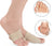 BunionFree™ Gel Bunion Sleeve - Bunion Free